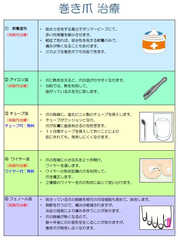 巻き爪 大和駅前皮フ科スキンクリニック